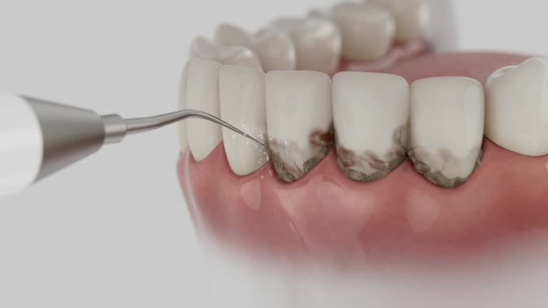 Trusted Teeth Cleaning And Checkup service in Dix Hills, NY - Dentist Open Now